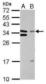 Anti-TFIIE beta antibody used in Western Blot (WB). GTX109005