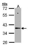 Anti-Napsin A antibody [N1C2] used in Western Blot (WB). GTX109006
