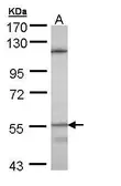 Anti-CYP4B1 antibody [N1N3] used in Western Blot (WB). GTX109008
