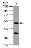 Anti-TPH1 antibody used in Western Blot (WB). GTX109027