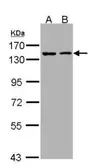 Anti-Eg5 antibody [C2C3], C-term used in Western Blot (WB). GTX109054