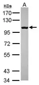 Anti-RP105 antibody [N2C1], Internal used in Western Blot (WB). GTX109057