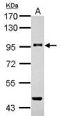 Anti-TGF beta Receptor III antibody used in Western Blot (WB). GTX109068