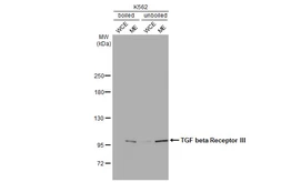Anti-TGF beta Receptor III antibody used in Western Blot (WB). GTX109068