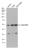 Anti-CEACAM7 antibody used in Western Blot (WB). GTX109081