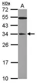 Anti-GAS41 antibody [N1C3] used in Western Blot (WB). GTX109088