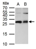 Anti-ETHE1 antibody used in Western Blot (WB). GTX109095
