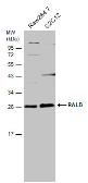 Anti-RALB antibody [N1C3] used in Western Blot (WB). GTX109101
