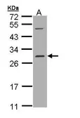 Anti-RALB antibody [N1C3] used in Western Blot (WB). GTX109101