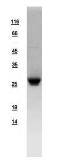 Human NNT1 protein, His tag. GTX109107-pro