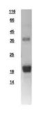 Human LMO2 protein, His tag. GTX109109-pro