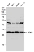 Anti-MTAP antibody [N1C3] used in Western Blot (WB). GTX109117