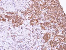 Anti-MTAP antibody [N1C3] used in IHC (Paraffin sections) (IHC-P). GTX109117