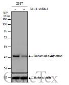 Anti-Glutamine synthetase antibody used in Western Blot (WB). GTX109121