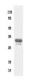 Human Glutamyl hydrolase Gamma protein, His tag. GTX109123-pro