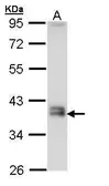 Anti-Glutamyl hydrolase gamma antibody [N1C3] used in Western Blot (WB). GTX109123