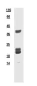 Human CHIC2 protein, His tag. GTX109124-pro
