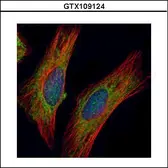 Anti-CHIC2 antibody used in Immunocytochemistry/ Immunofluorescence (ICC/IF). GTX109124