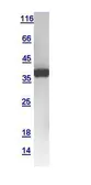 Human CD42a protein, GST tag. GTX109134-pro