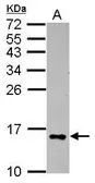 Anti-Galectin 2 antibody used in Western Blot (WB). GTX109135