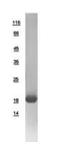 Human Cardiac Troponin C protein, His tag. GTX109139-pro