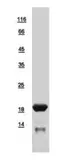 Human FHIT protein, His tag. GTX109141-pro