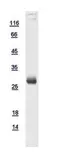 Human HOXA1 protein, His tag. GTX109148-pro