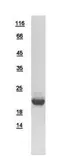Human DUSP3 protein, His tag. GTX109149-pro