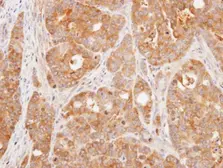 Anti-DUSP3 antibody [N1C3] used in IHC (Paraffin sections) (IHC-P). GTX109149