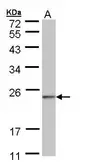Anti-HRPAP20 antibody [N1C3] used in Western Blot (WB). GTX109156