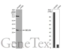 Anti-BCL10 antibody [N1C3] used in Western Blot (WB). GTX109159