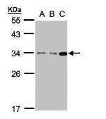 Anti-BCL10 antibody [N1C3] used in Western Blot (WB). GTX109159