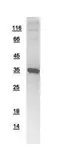Human LHX8 protein, His tag. GTX109165-pro