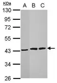 Anti-HIBCH antibody used in Western Blot (WB). GTX109167
