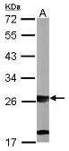 Anti-SBDS antibody [N1C3] used in Western Blot (WB). GTX109168