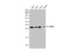 Anti-SBDS antibody [N1C3] used in Western Blot (WB). GTX109168