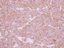 Anti-SBDS antibody [N1C3] used in IHC (Paraffin sections) (IHC-P). GTX109168