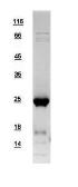Human SAR1B protein, His tag. GTX109170-pro