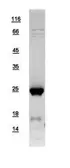 Human SAR1B protein, His tag. GTX109170-pro