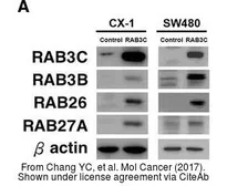 Anti-RAB27A antibody [N1C3] used in Western Blot (WB). GTX109180
