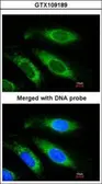 Anti-ETFB antibody [N1C3] used in Immunocytochemistry/ Immunofluorescence (ICC/IF). GTX109189