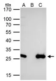 Anti-EN2 antibody used in Immunoprecipitation (IP). GTX109198
