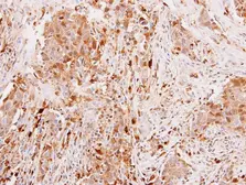 Anti-Leptin antibody used in IHC (Paraffin sections) (IHC-P). GTX109204