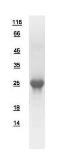 Human Beta A3 Crystallin protein, His tag. GTX109207-pro