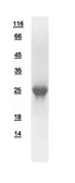 Human Beta A3 Crystallin protein, His tag. GTX109207-pro