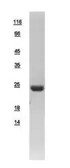 Human Beta Crystallin S protein, His tag. GTX109208-pro