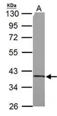 Anti-SUCLG1 antibody used in Western Blot (WB). GTX109215