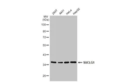 Anti-SUCLG1 antibody used in Western Blot (WB). GTX109215