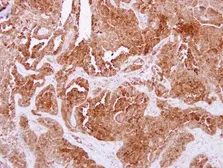 Anti-NPC2 antibody [N1C3] used in IHC (Paraffin sections) (IHC-P). GTX109217