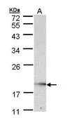 Anti-UBE2G2 antibody [N1C3] used in Western Blot (WB). GTX109224